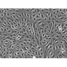 Human Coronary Artery Endothelial Cells (HCAECs)